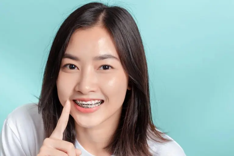 dental braces young asian woman wearing metal braces beauty smile - How to Get Braces Glue Off Teeth in Houston and Richmond, TX