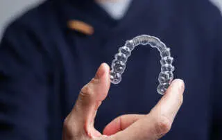 Invisalign Aligners