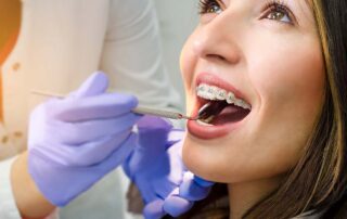 woman getting braces