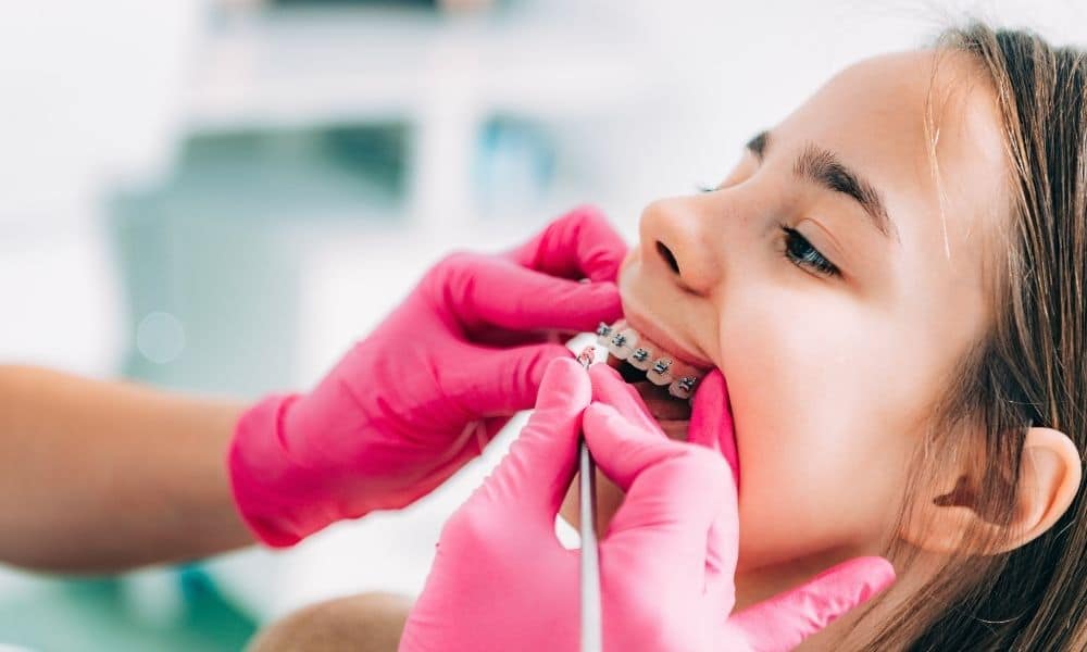 Simple Ways To Help Your Child Adjust to Braces