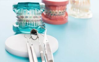 importance of orthodontics