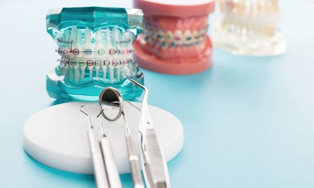 Why Are Orthodontics Important 3 Essential Reasons