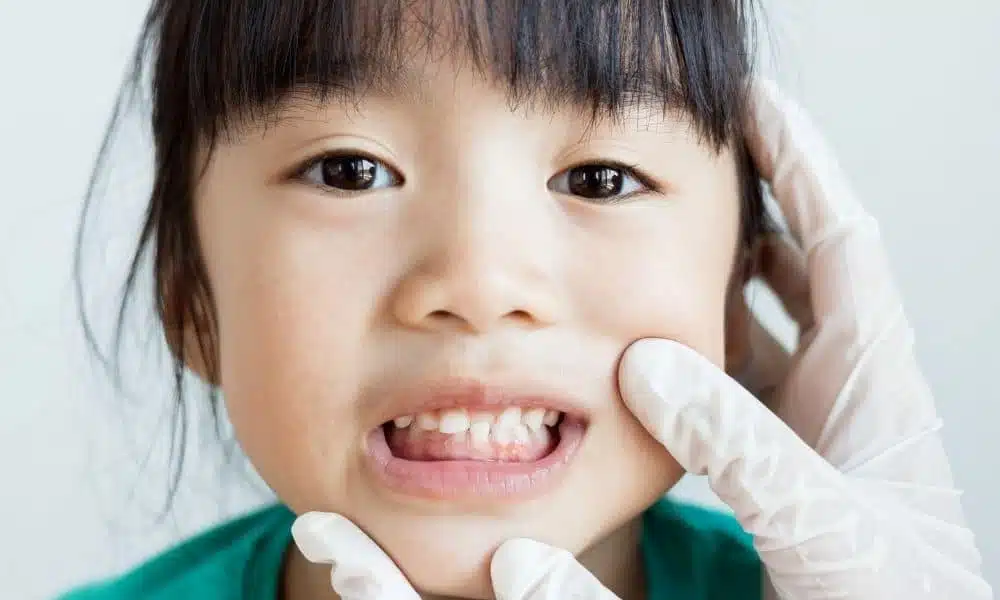 5 Signs You Should Bring Your Child To an Orthodontist