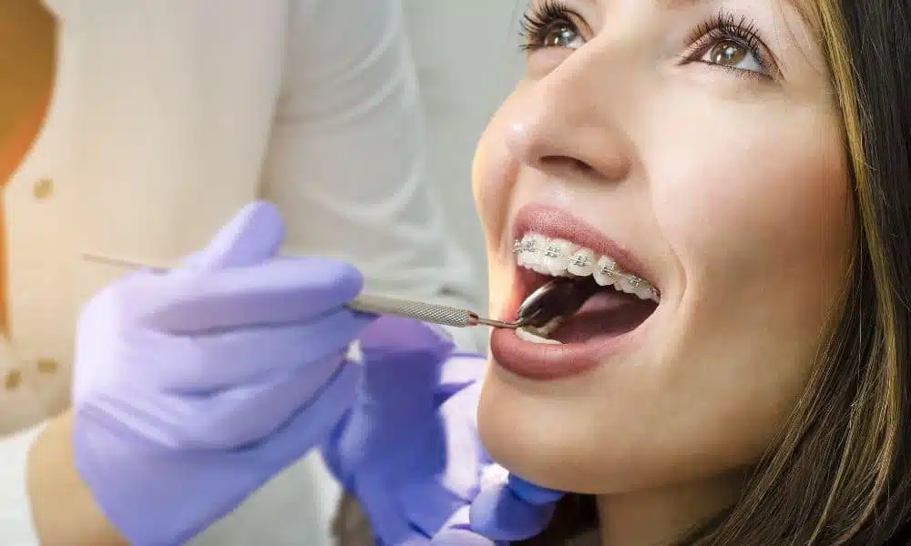 Myths and Misconceptions About Braces