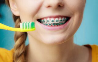 Caring for Your Braces