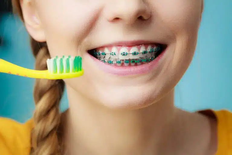 Caring for Your Braces