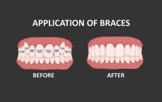 common Orthodontics Issues and Treatment Options