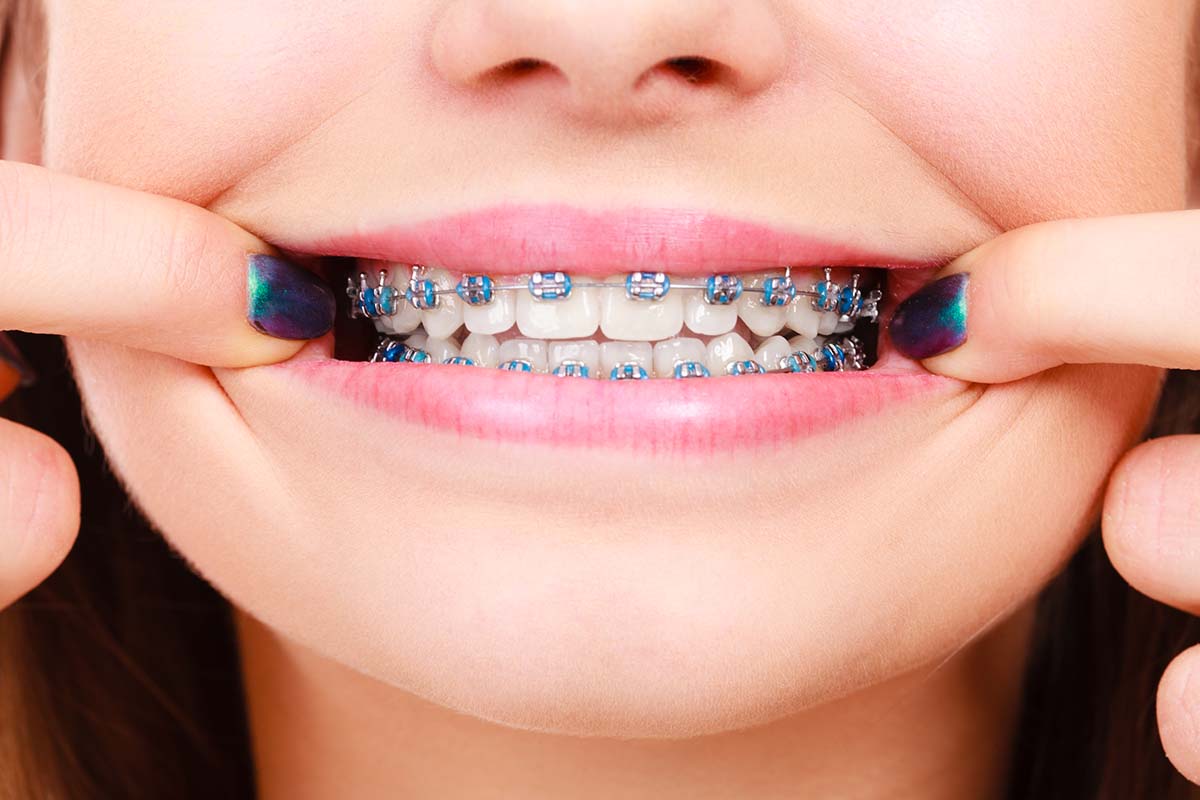 Young Child with Braces