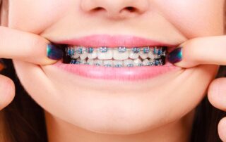 Evolution of Orthodontics