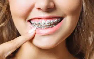 Happy girl with Braces
