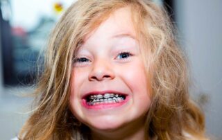 Girl with Retainer