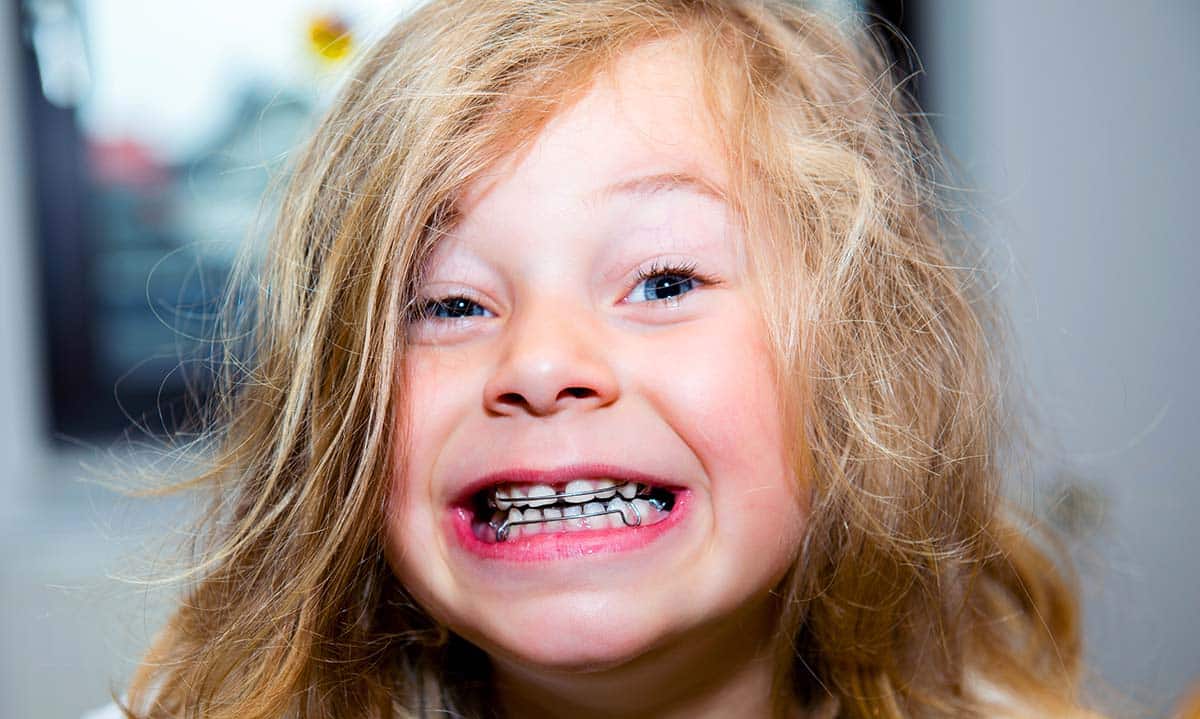 Girl with Retainer