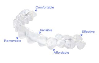 Invisalign Myth