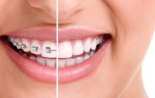 Orthodontics and Overall Health