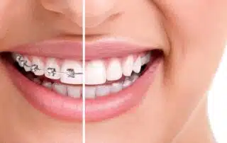 Orthodontics and Overall Health