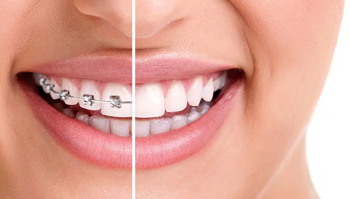 Orthodontics and Overall Health