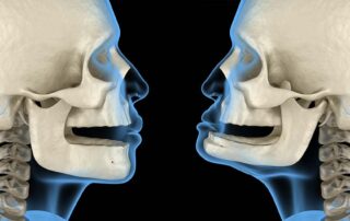 Jaw Alignment