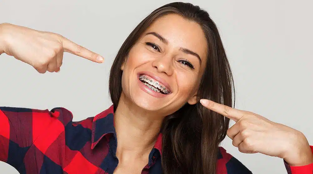 showcase-braces Woman with Braces