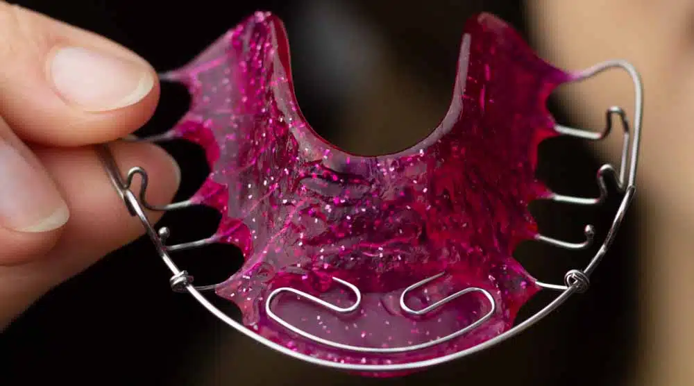 retainer-2 Woman with Braces