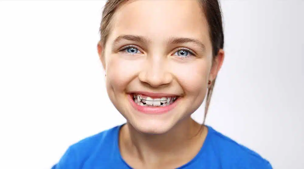retainers-3 Young Girl with Retainer