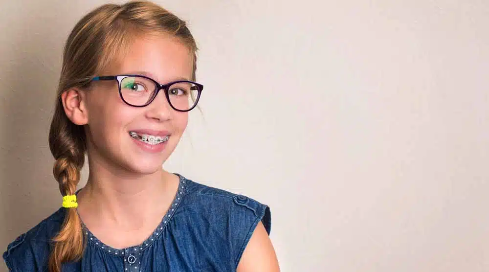 retainers-for-braces Woman with Braces