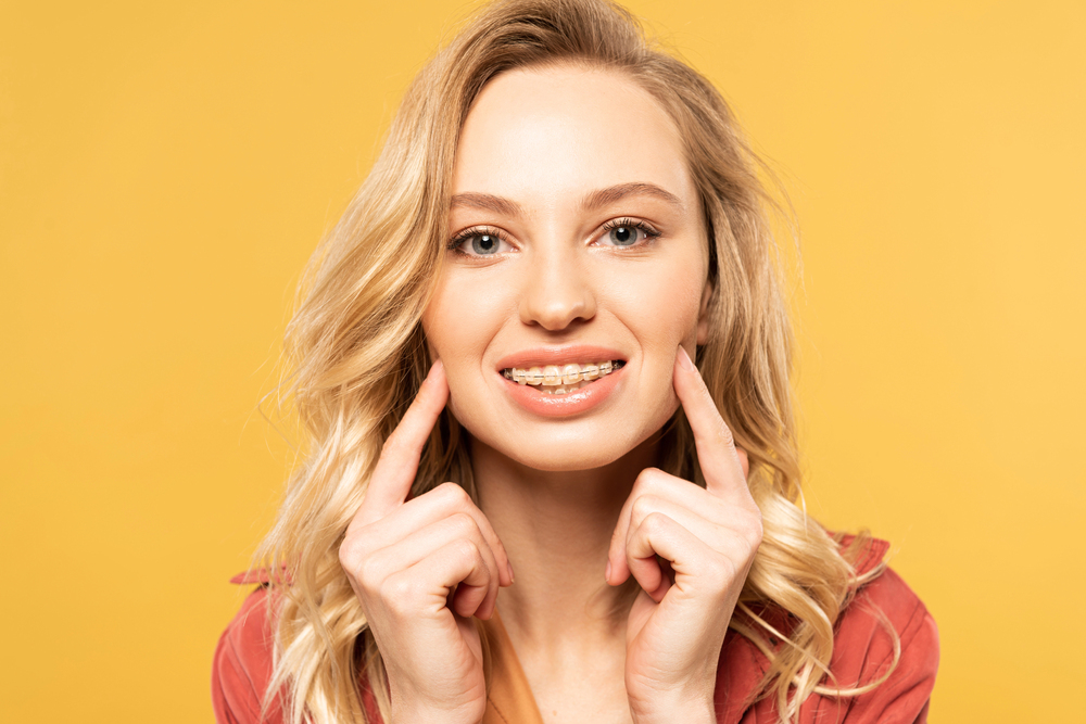 A young blonde woman smiles and points to her clear braces in front of a yellow background at Elara Orthodontics in Houston, TX.