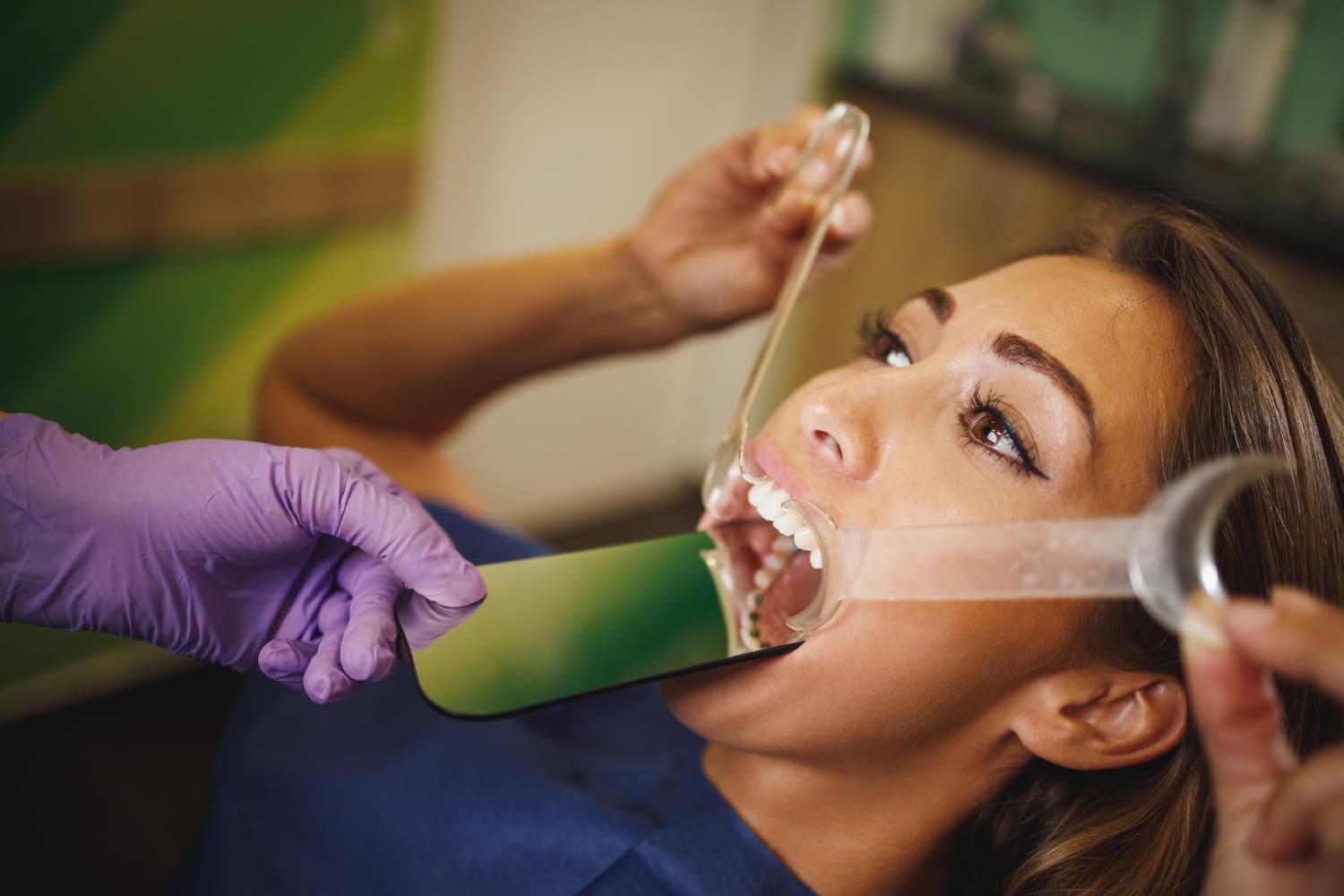 During an exam or lingual braces check at Elara Orthodontics in Richmond TX, a dental professional uses tools to keep a patient’s mouth open.
