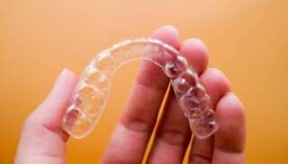 picture of aligner