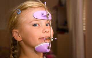 a girl wearing purple pull reverse headgear braces in Richmond, TX