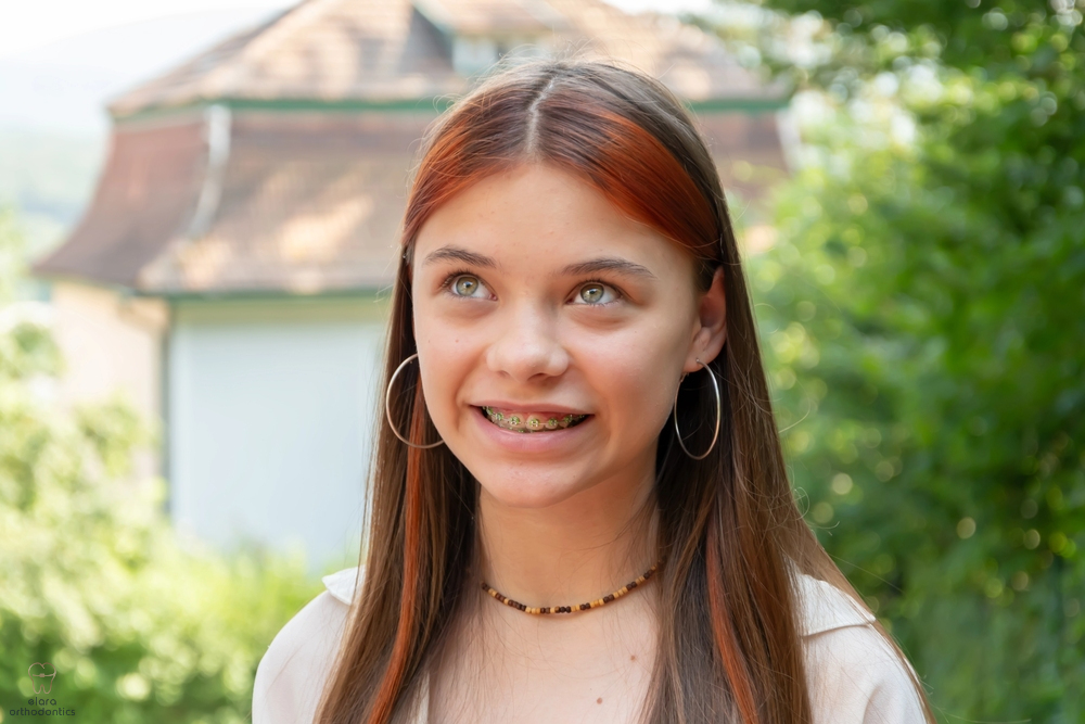 beautiful teenage girl metal braces smile street - How to Clean Braces in Houston and Richmond, TX