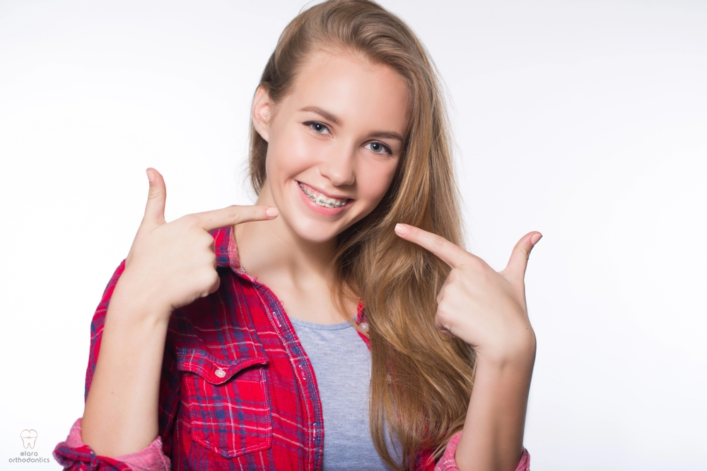 beautiful young blondie girl showing her metal braces isolated white - How to Get Braces Glue Off Teeth in Houston and Richmond, TX