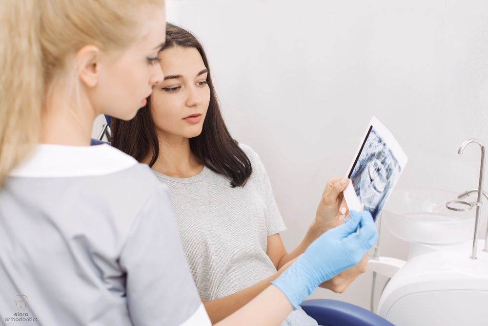 dentist showing x-ray image to patient - Mouth Breather Face in Houston and Richmond, TX 
