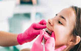 Importance of Dental Braces for Kids