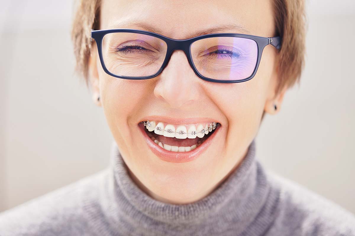 woman laughing with braces